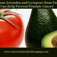 Lutein from Avocados and Lycopene from Tomatoes Can Help Prevent Prostate Cancer