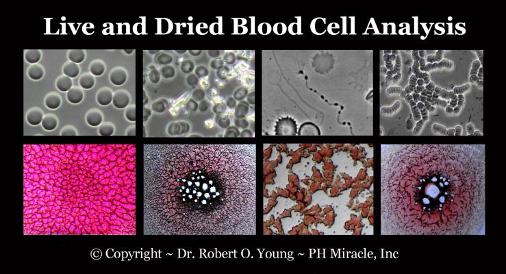Live and Dried Blod Analysis - Copyright ROY