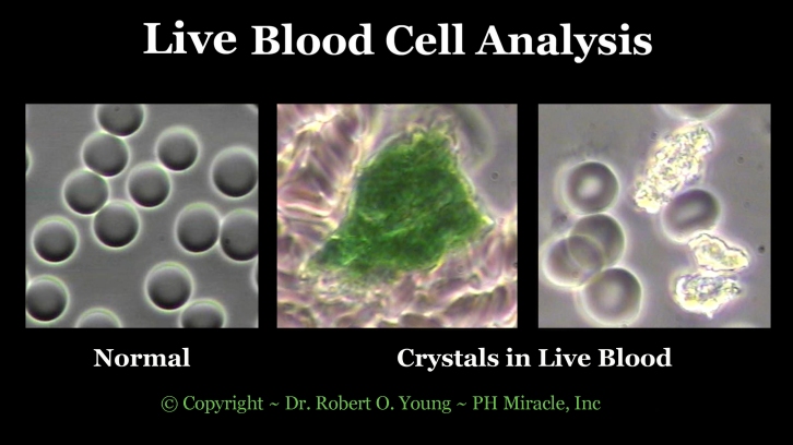 Live Blod Analysis - Crystals .Copyright ROY