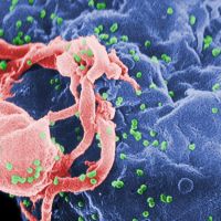 Second Thoughts About Viruses, Vaccines, and the HIV/AIDS Hypothesis
