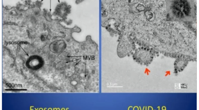 What Do Exosomes and Viruses Like HIV & Corona Have In Common?